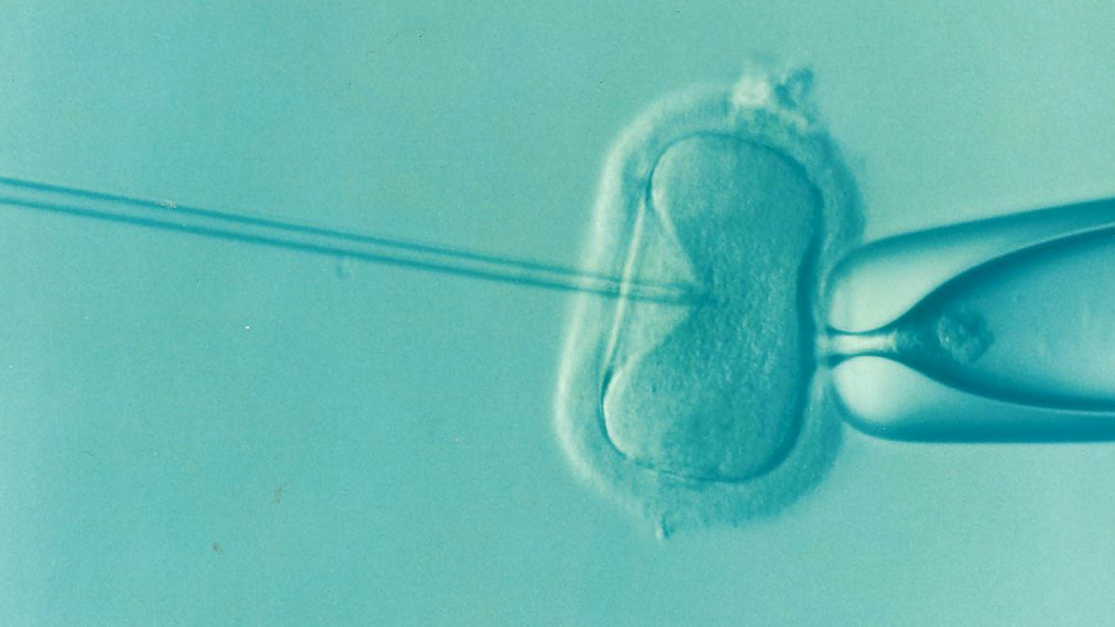 Pierwsze kroki w diagnozie niepłodności