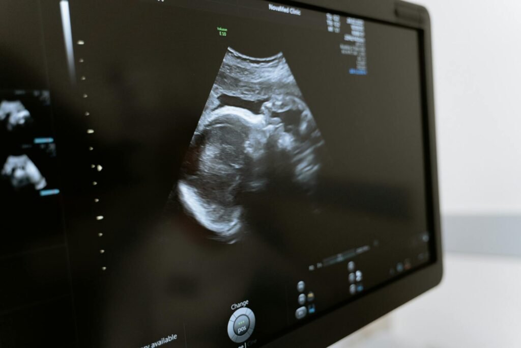 Monitor urządzenia do badania USG płodu z widocznym na nim obrazem płodu